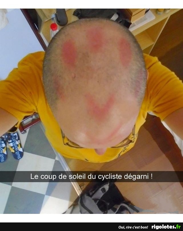 Le Coup De Soleil Du Cycliste Blagues Et Les Meilleures Images Droles